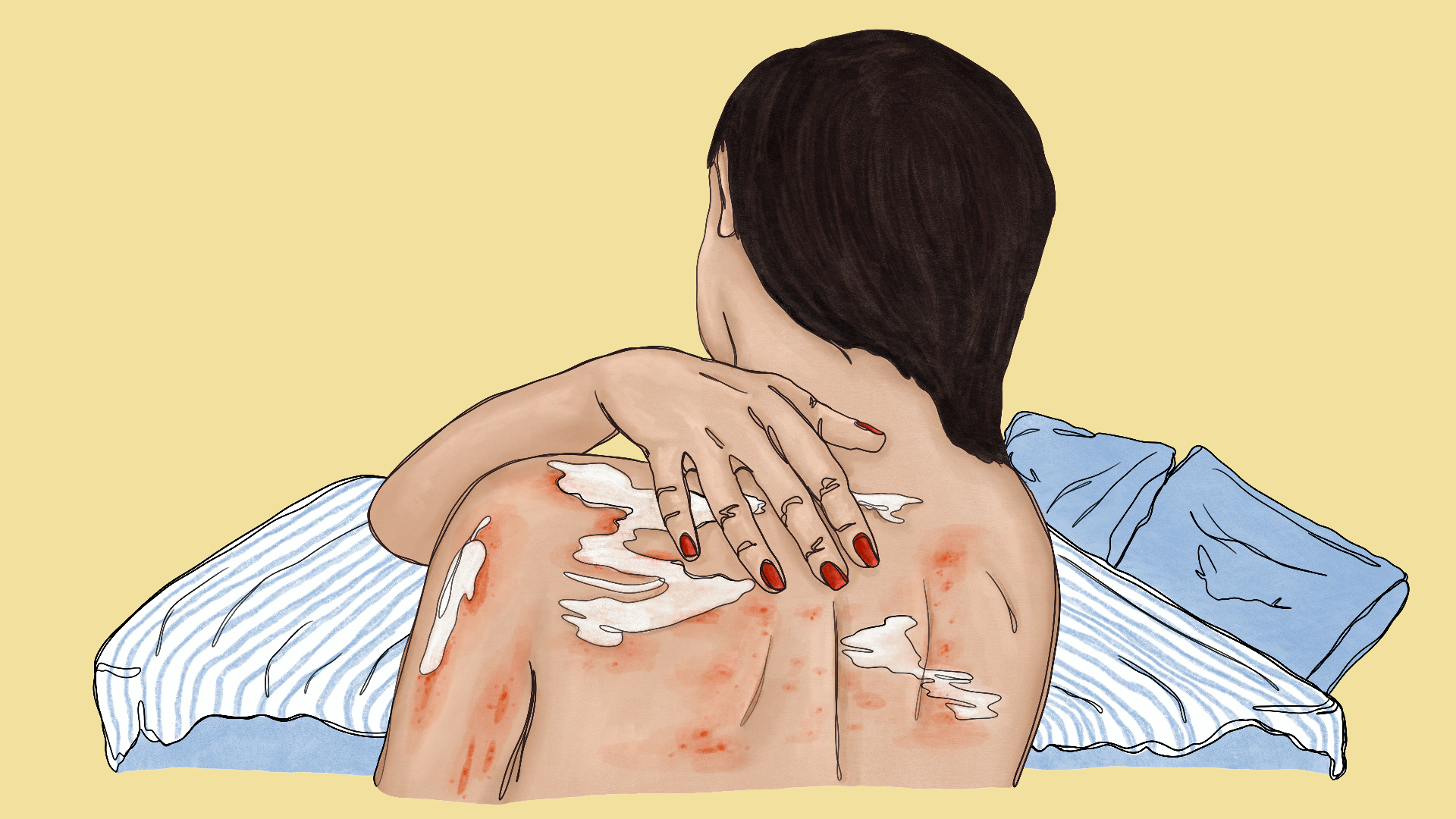 Illustrasjon Andrea Skovdahl